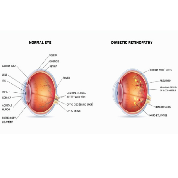 Noor Malabar Eye Hospital+Medical and Surgical Retina